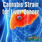 Cannabis Strain for Liver Cancer